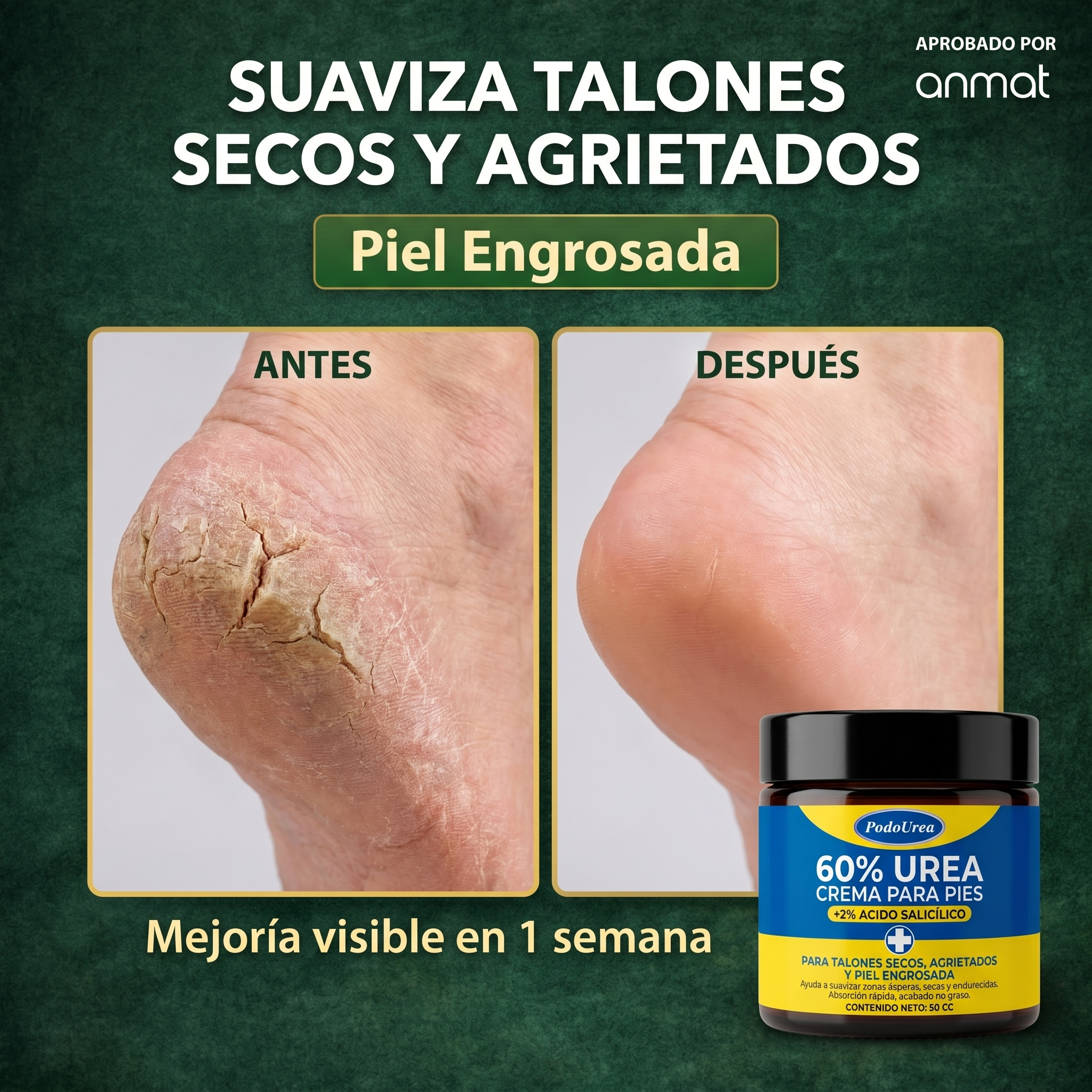 UreaPodo™ Crema Restauradora
